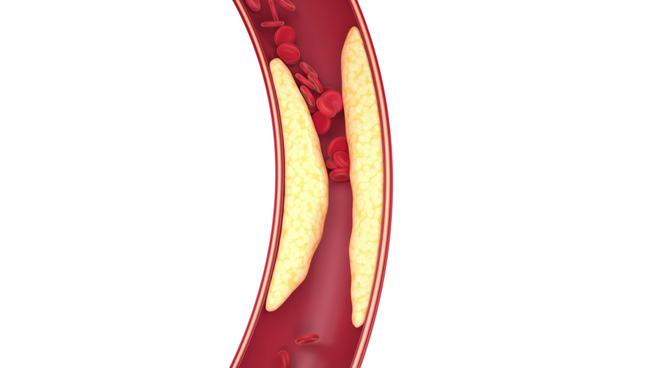 血管中的脂肪与细胞 3D渲染视频素材