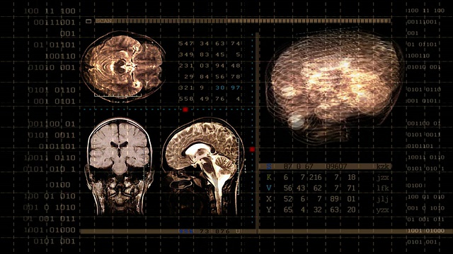 大脑核磁共振视频素材