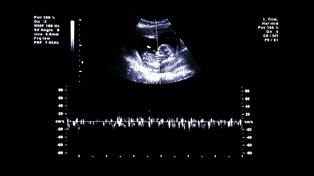 超声波视频素材