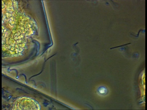跨越淡水样本观察螺旋体细菌和鞭毛在藻类细胞周围移动，相对比视频素材