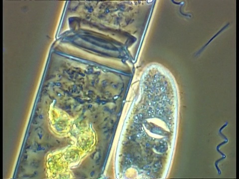 草履虫和螺旋体细菌在藻类细胞周围移动视频素材