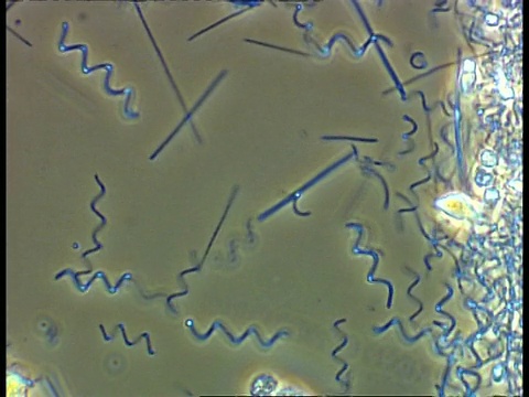 大量螺旋体细菌和其他细菌在池塘水中移动。相衬;良好的能动性视频素材