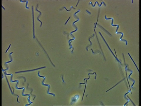 螺旋体细菌和其他在池塘水中移动的细菌。相衬;良好的能动性视频素材