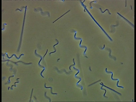 螺旋体细菌和其他在池塘水中移动的细菌。相衬;良好的能动性视频素材