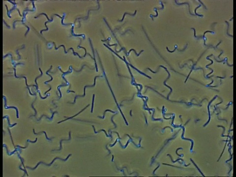 螺旋体细菌和其他在池塘水中移动的细菌。相衬;良好的能动性视频素材