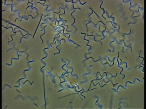 螺旋体细菌和其他在池塘水中移动的细菌。相衬;良好的能动性视频素材