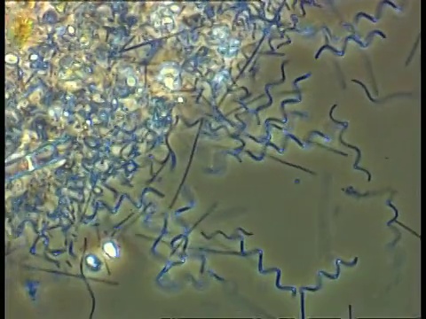 在螺旋体细菌和其他在池塘水中移动的细菌样本上四处移动。相衬视频素材