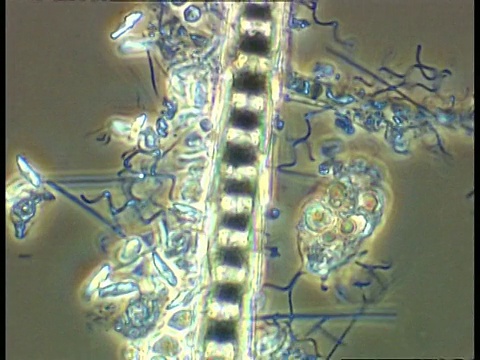 在池塘样本中追踪丝状藻类的细丝。相衬视频素材