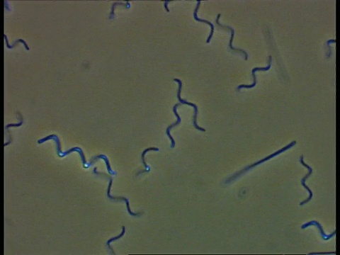 螺旋体细菌和其他在池塘水中移动的细菌。相衬视频素材