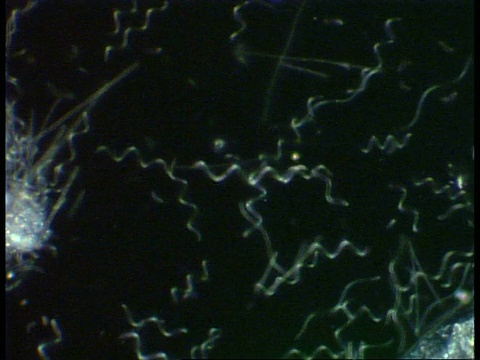 螺旋体和其他细菌在池塘水中移动。暗视野视频素材