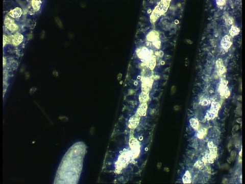 靠近植物细胞移动的纤毛虫。暗视野视频素材