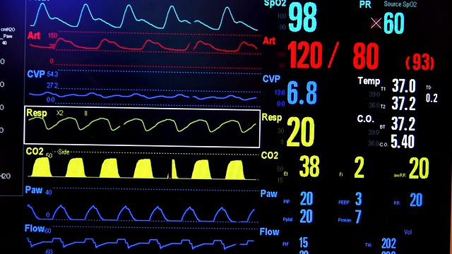 加护病房监控(高清)视频素材