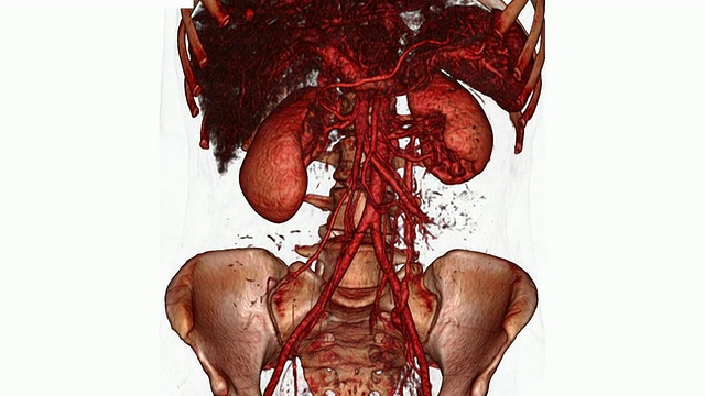 三维CT扫描的CGI重建显示肾脏、主动脉和腹部骨骼视频素材