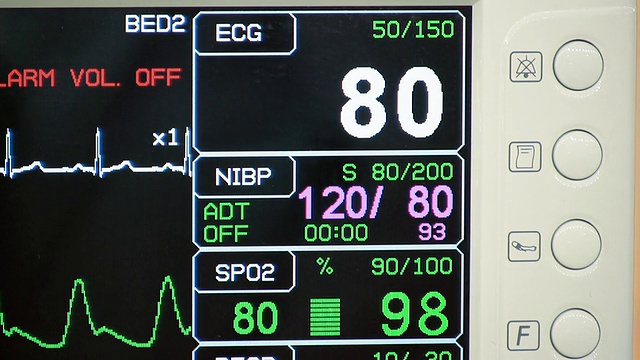 ICU心脏监护仪(HD)视频素材