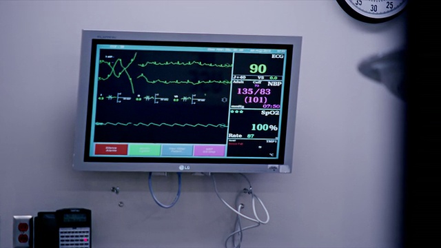 特写，医院手术室心电图监护仪，外科医生在前台视频素材