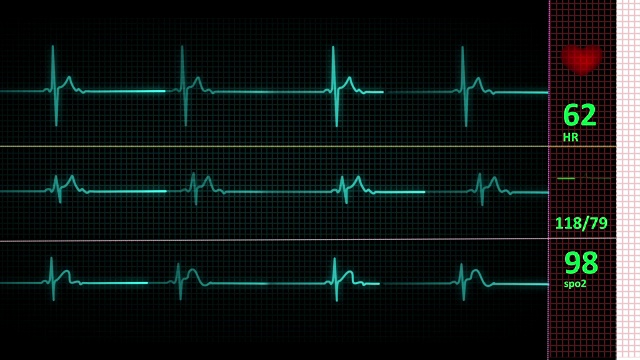 心电图(LOOP)视频素材