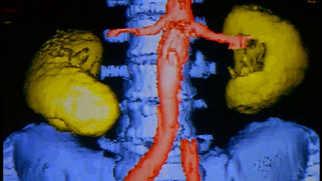 近距离电脑显示脊柱、髋骨和肾脏的CGI模型视频素材