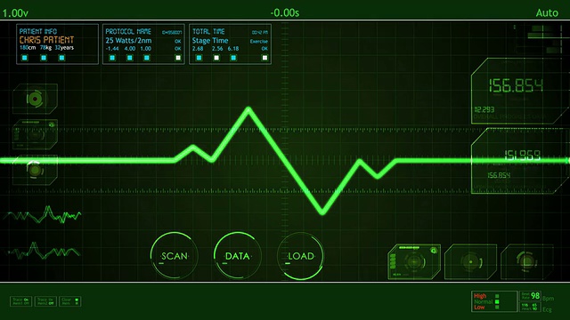心电图脉冲波形屏幕HUD视频素材