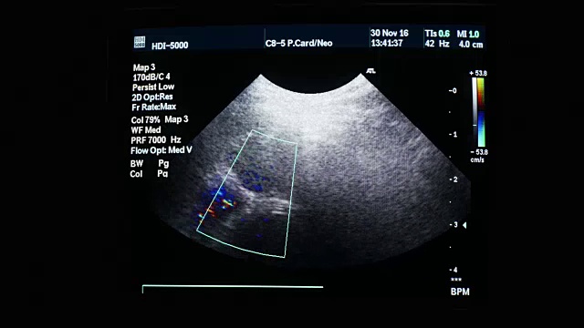 医用超声波病狗4k视频素材