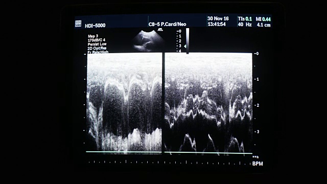 医用超声波病狗4k视频素材