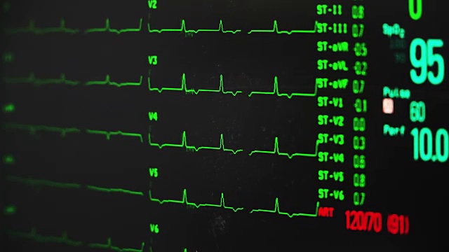 生命体征监测视频下载