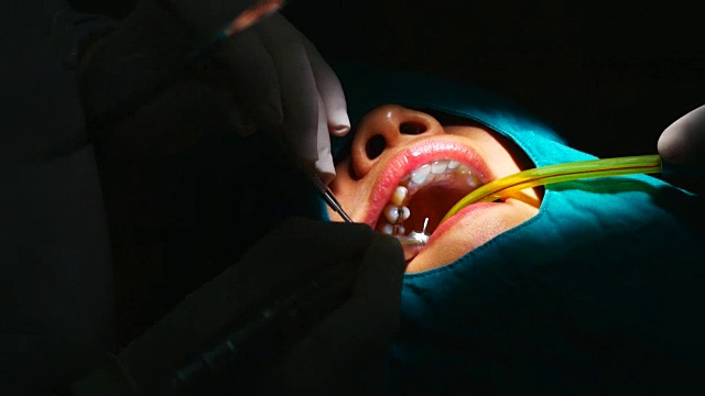 牙医为女牙医治疗牙齿视频素材