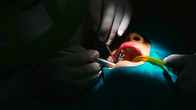 牙医为女牙医治疗牙齿视频素材