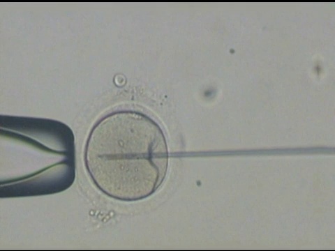 精子注射(NTSC)视频下载