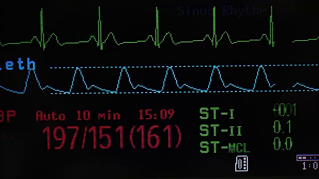 生命体征监测视频素材