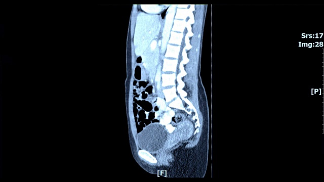 身体内部扫描图像视频素材