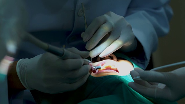 牙医治疗牙齿，矫正牙齿视频素材