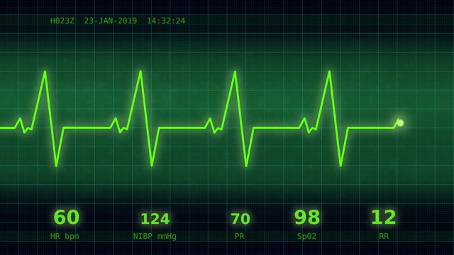 监视器上的心跳表视频素材