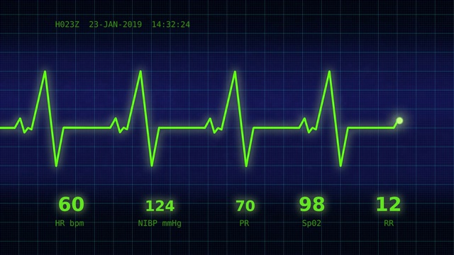 监视器上的心跳表视频素材