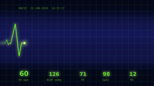 监视器上的心跳表视频素材
