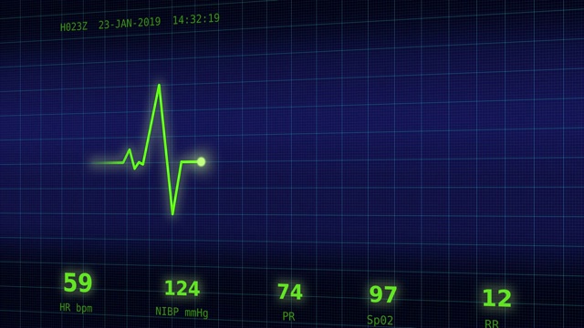 监视器上的心跳表视频下载
