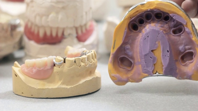 医生展示了颌骨的布局模板和移除牙冠视频素材