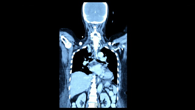 身体正面扫描图像视频素材