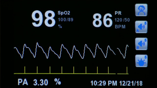 医院的心电图监测器。血氧饱和度，心率。视频素材