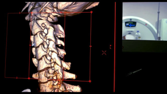 颈椎(颈椎)三维渲染成像视频素材