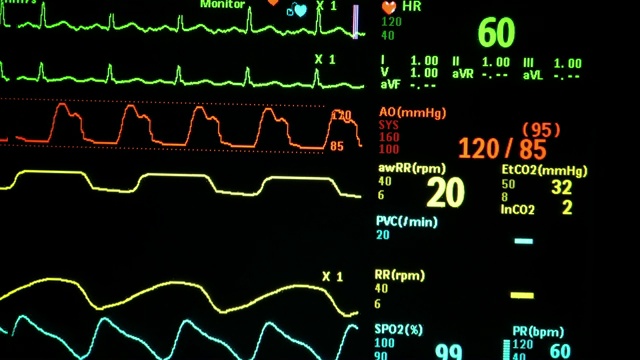 生命体征监测视频素材