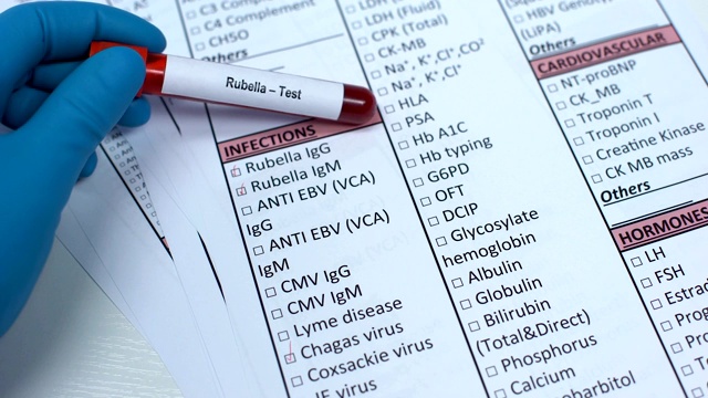 风疹，医生在实验室空白中检查疾病，试管中显示血液样本视频素材