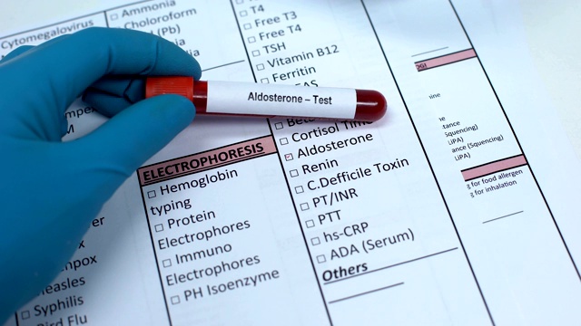 醛固酮，医生检查激素在实验室空白，显示血液样本管视频素材