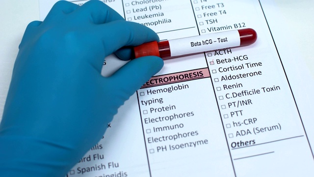 人绒毛膜促性腺激素，医生在实验室空白区检查疾病，试管中显示血液样本视频素材