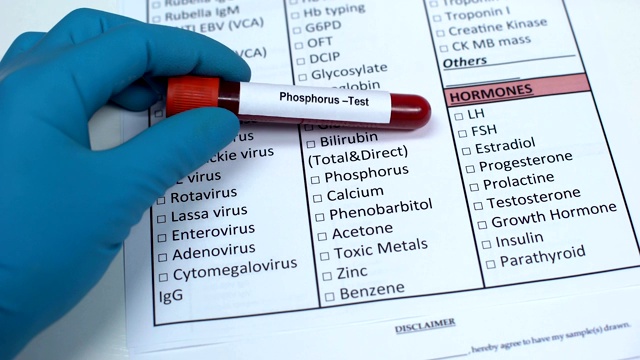 磷，医生检查矿物质在实验室空白，显示血液样本管视频素材