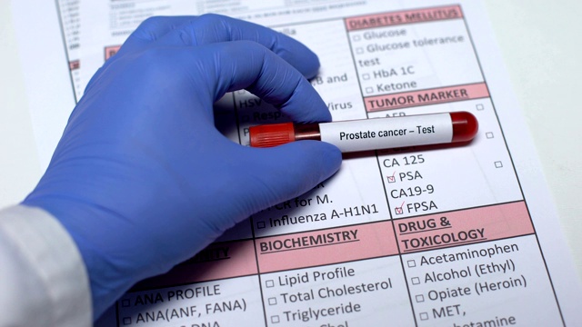 前列腺癌，医生在实验室空白区检查疾病，显示血液样本视频素材