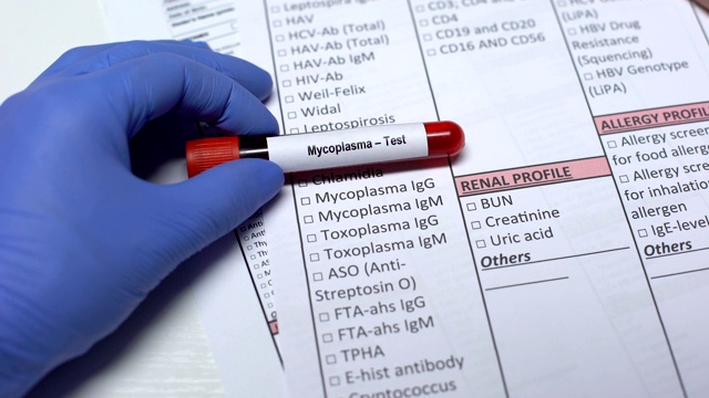 支原体，医生在实验室空白中检查疾病，试管中显示血液样本视频素材