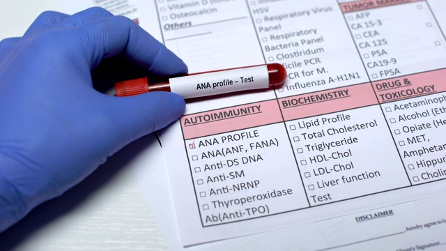 抗核抗体，医生在实验室空白中检查疾病，试管中显示血液样本视频素材
