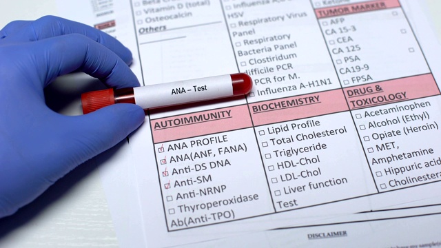 抗核抗体试验:医生在实验室空白中检查疾病，试管中显示血液样本视频素材