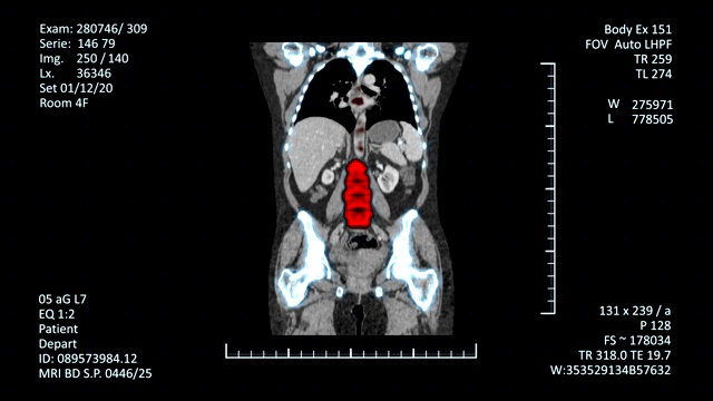现代MRI扫描屏幕视频素材