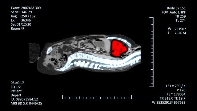MRI扫描监视器与CT图像视频素材